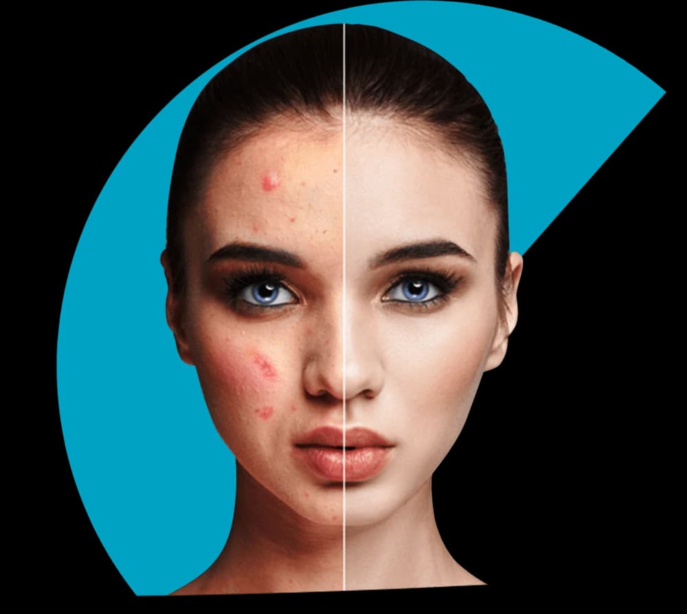 Before and after retouching